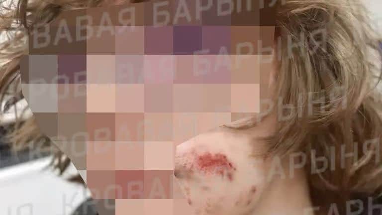 Photo: Bloody Lady Telegram channel